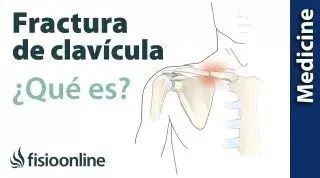 lesión, lesiones, lesion, fisioterapia, salud, fractura, clavicula, clavícula