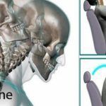 lesión, lesiones, lesion, fisioterapia, salud, latigazo, cervical, síndrome, sindrome, sindrome del latigazo cervical, síndrome del latigazo cervical