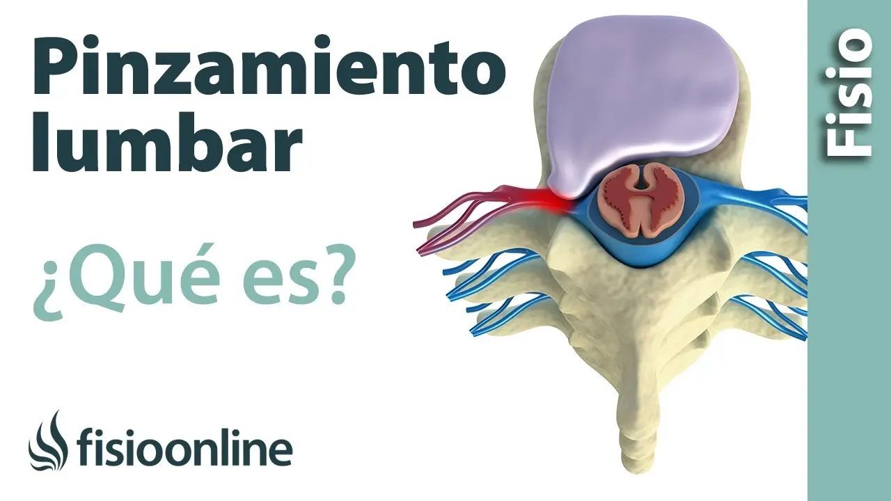 lesión, lesiones, salud, fisioterapia, pinzamiento