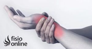 lesiones, fisioterapia, baloncesto, lesión, lesion, sindrome, síndrome, nervio, interoseo, interóseo, posterior