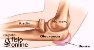lesiones, fisioterapia, baloncesto, lesión, lesion, bursa, bursitis, olécranon, olecranon