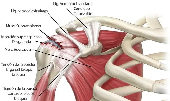 lesiones, fisioterapia, baloncesto, lesión, lesion, rotura, manguito, rotadores, hombro